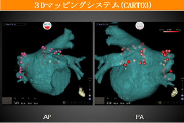 当院で使用できる3Dマッピングシステム1